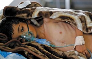 اليمن: ٥٥ ألف حالة إصابة في الكوليرا اغلبهم من الأطفال.